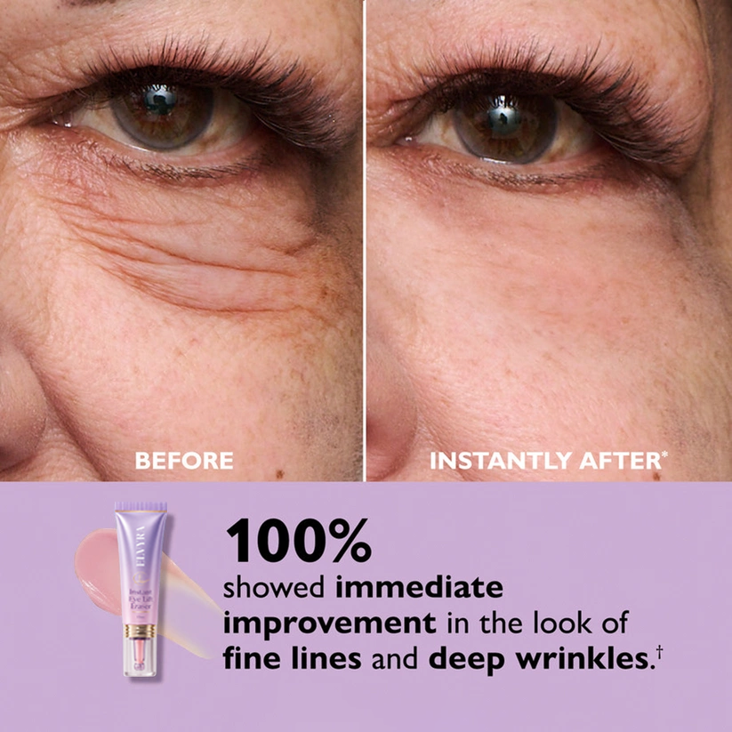 🎁Today’s Special Offer | ELVYRA™ Instant Eye Lift Eraser–Visibly Tighten, Firm & Blur Wrinkles