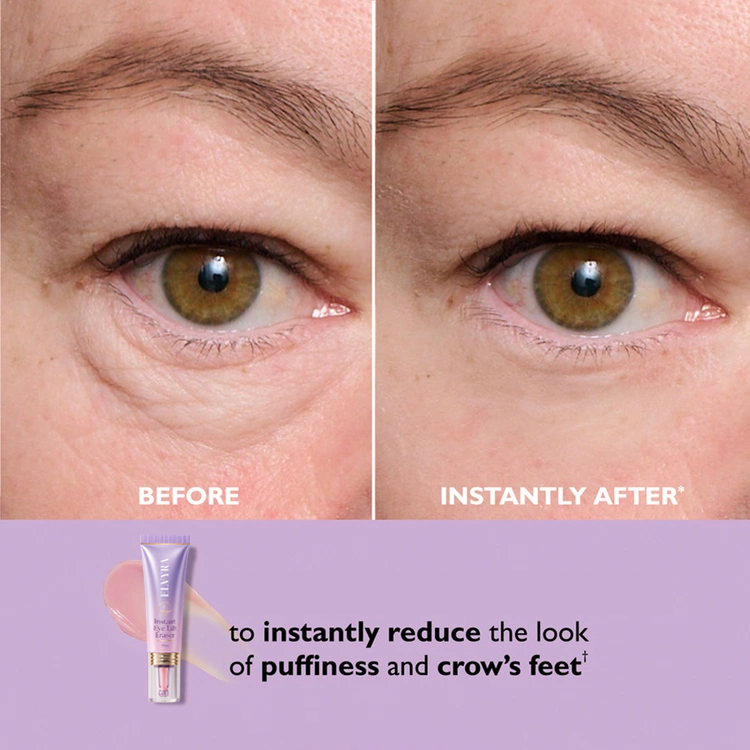 🎁Today’s Special Offer | ELVYRA™ Instant Eye Lift Eraser–Visibly Tighten, Firm & Blur Wrinkles
