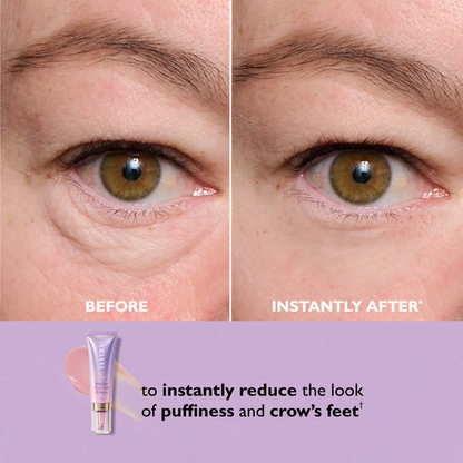 🎁Today’s Special Offer | ELVYRA™ Instant Eye Lift Eraser–Visibly Tighten, Firm & Blur Wrinkles