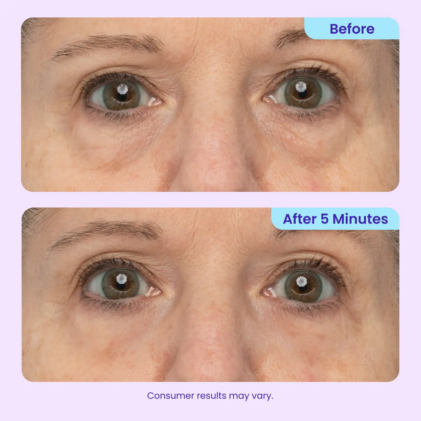 🎁Today’s Special Offer | ELVYRA™ Instant Eye Lift Eraser–Visibly Tighten, Firm & Blur Wrinkles