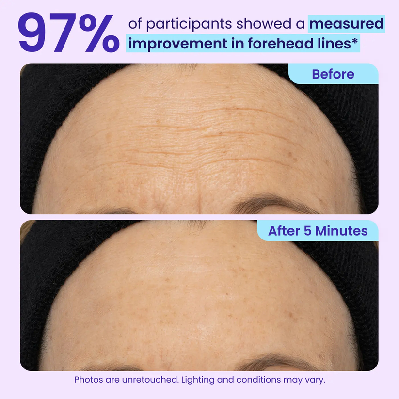 🎁Today’s Special Offer | ELVYRA™ Instant Eye Lift Eraser–Visibly Tighten, Firm & Blur Wrinkles