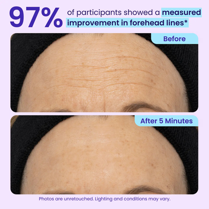 🎁Today’s Special Offer | ELVYRA™ Instant Eye Lift Eraser–Visibly Tighten, Firm & Blur Wrinkles
