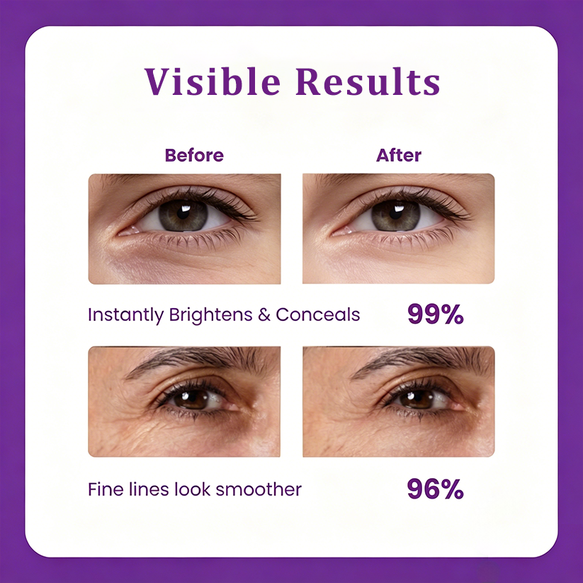 ELVYRA™ Eye Cream – Reduce Puffiness, Dark Circles & Fine Lines