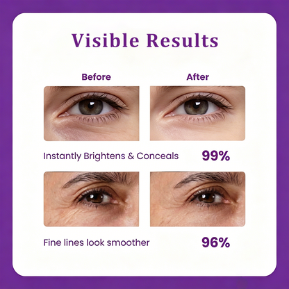 ELVYRA™ Eye Cream – Reduce Puffiness, Dark Circles & Fine Lines