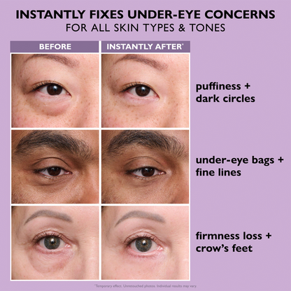 🎁Today’s Special Offer | ELVYRA™ Instant Eye Lift Eraser–Visibly Tighten, Firm & Blur Wrinkles